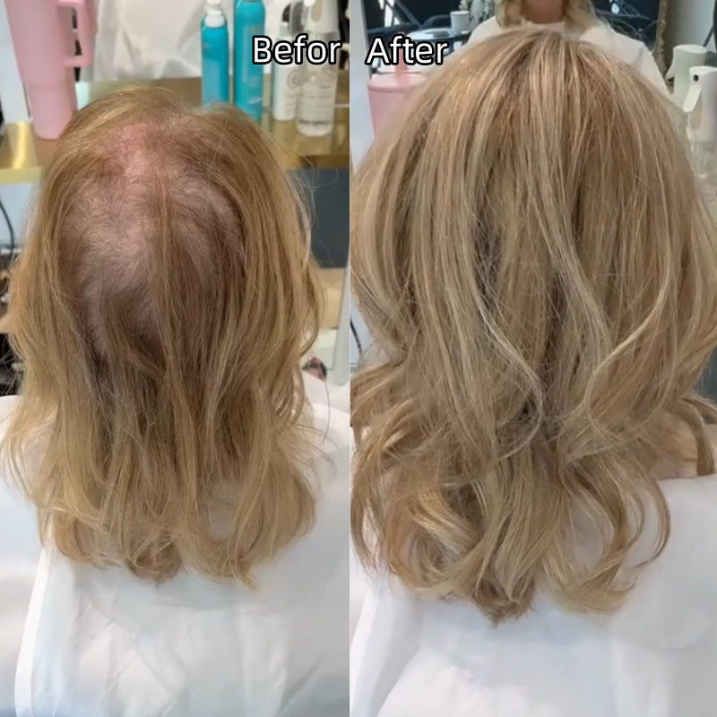 🌟2026 New Lightweight & Breathable Wavy Hair Topper✨